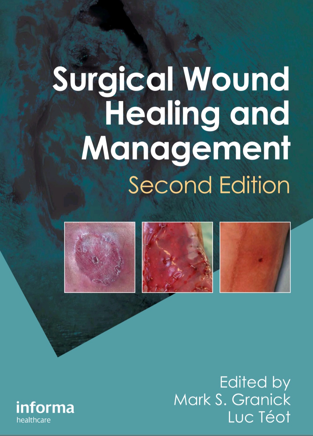 مدیریت و ترمیم زخم های جراحی Surgical Wound Healing and Management