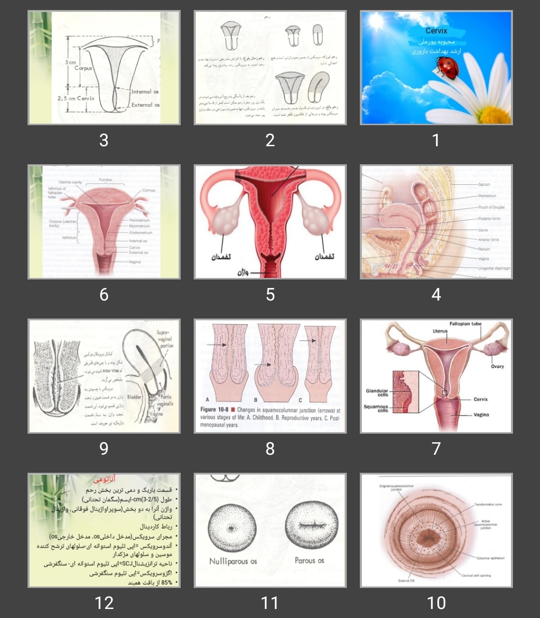 پاورپوینت Cervix