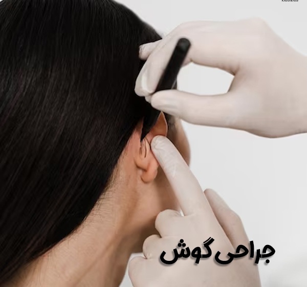 جزوه جراحی گوش دکتر موسوی - دست نویس