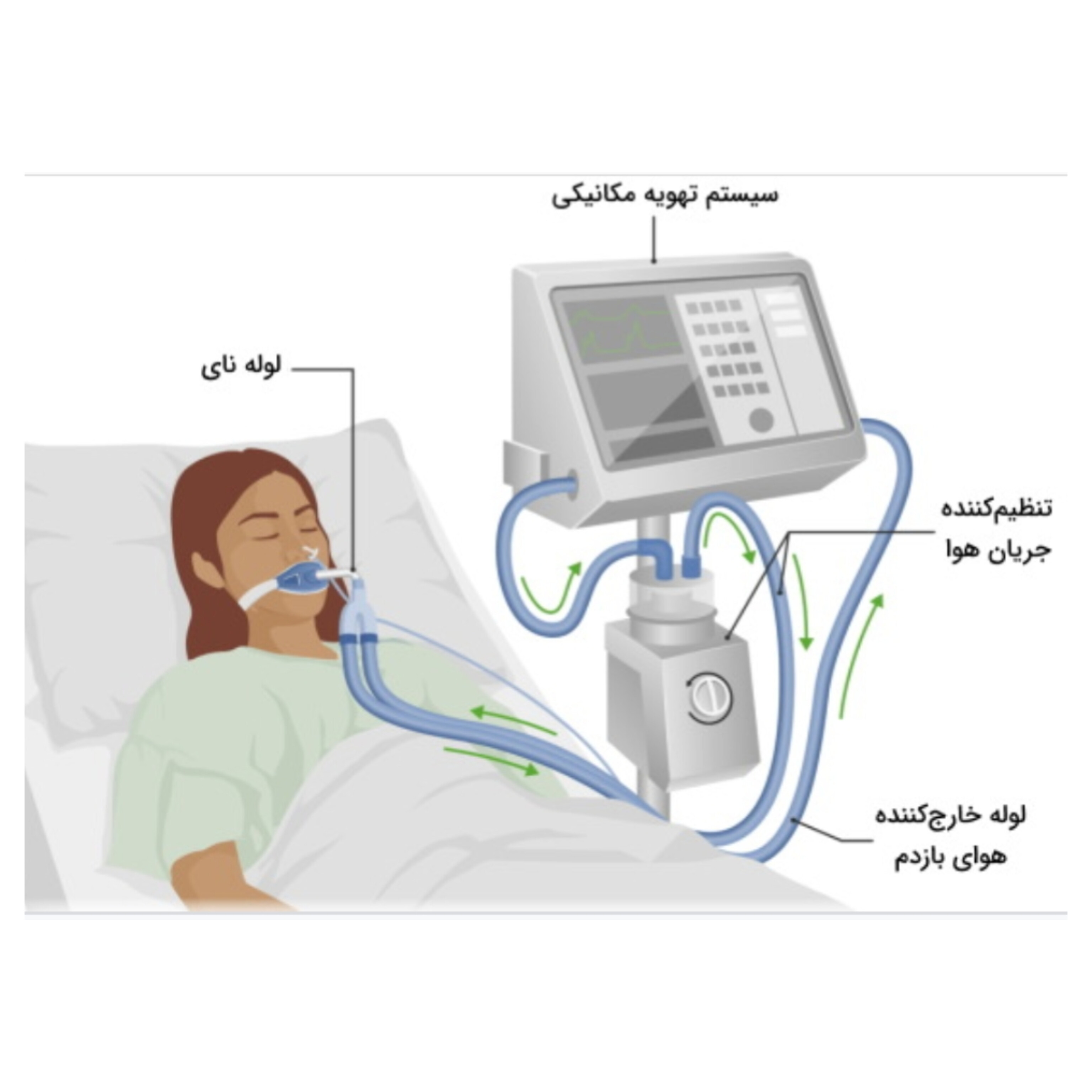 جزوه کامل و خلاصه انواع ونتیلاتور