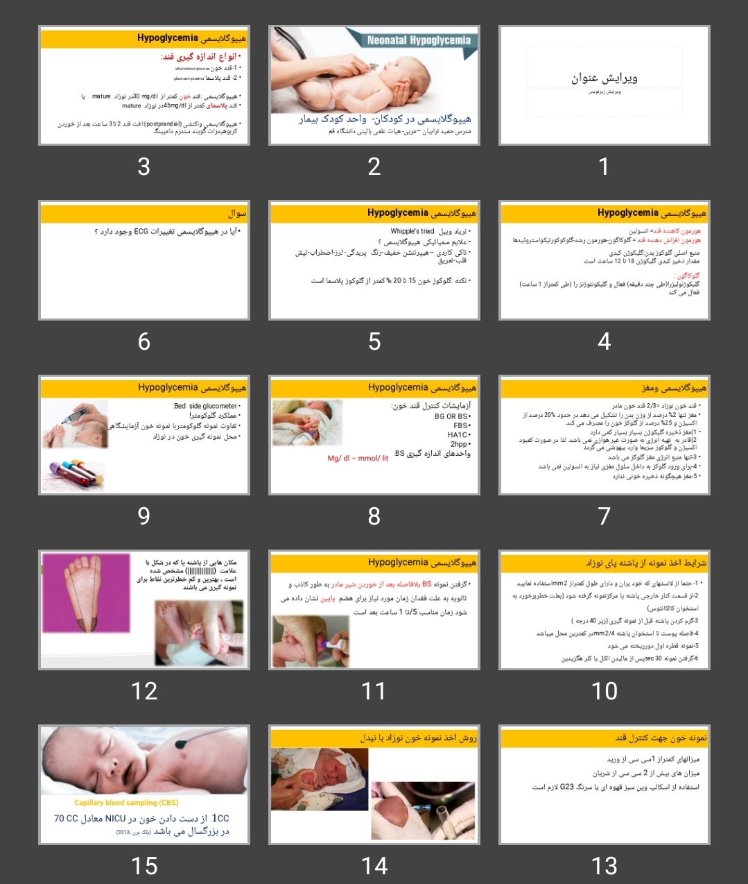پاورپوینت هیپوگلایسمی Hypoglycemia