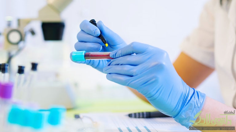 پمفلت آموزشی اخذ نمونه جهت آناليز گاز خون شرياني