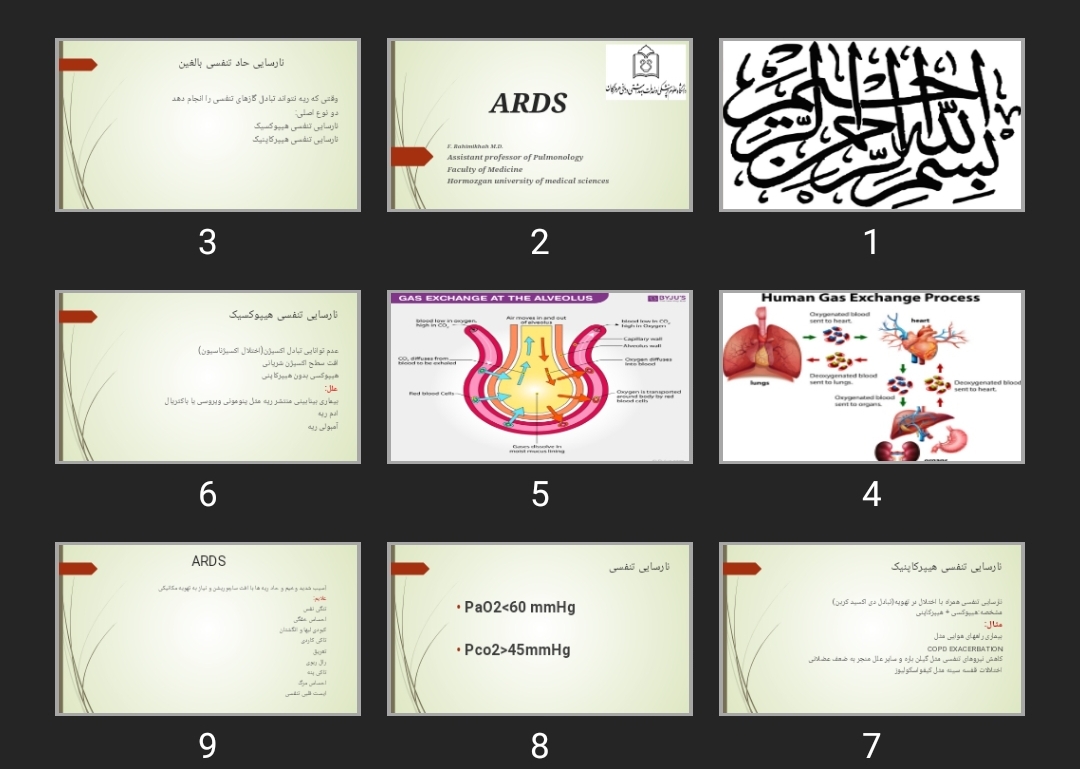 پاورپوینت ARDS