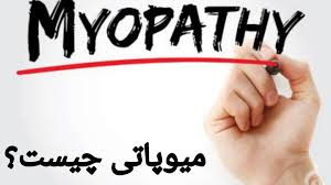   پاورپوینت میوپاتی