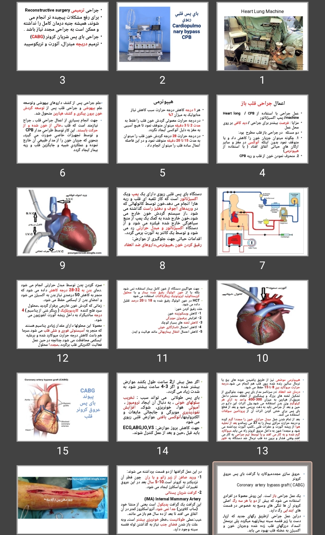 پاورپوینت جراحی قلب