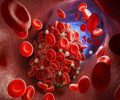   جزوه هماتو ( خون ) دانشگاه علوم پزشکی ایران