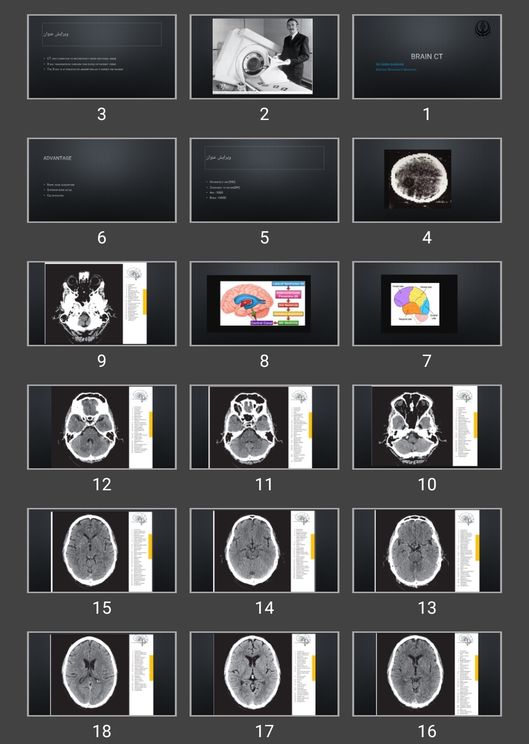 پاورپوینت Brain CT