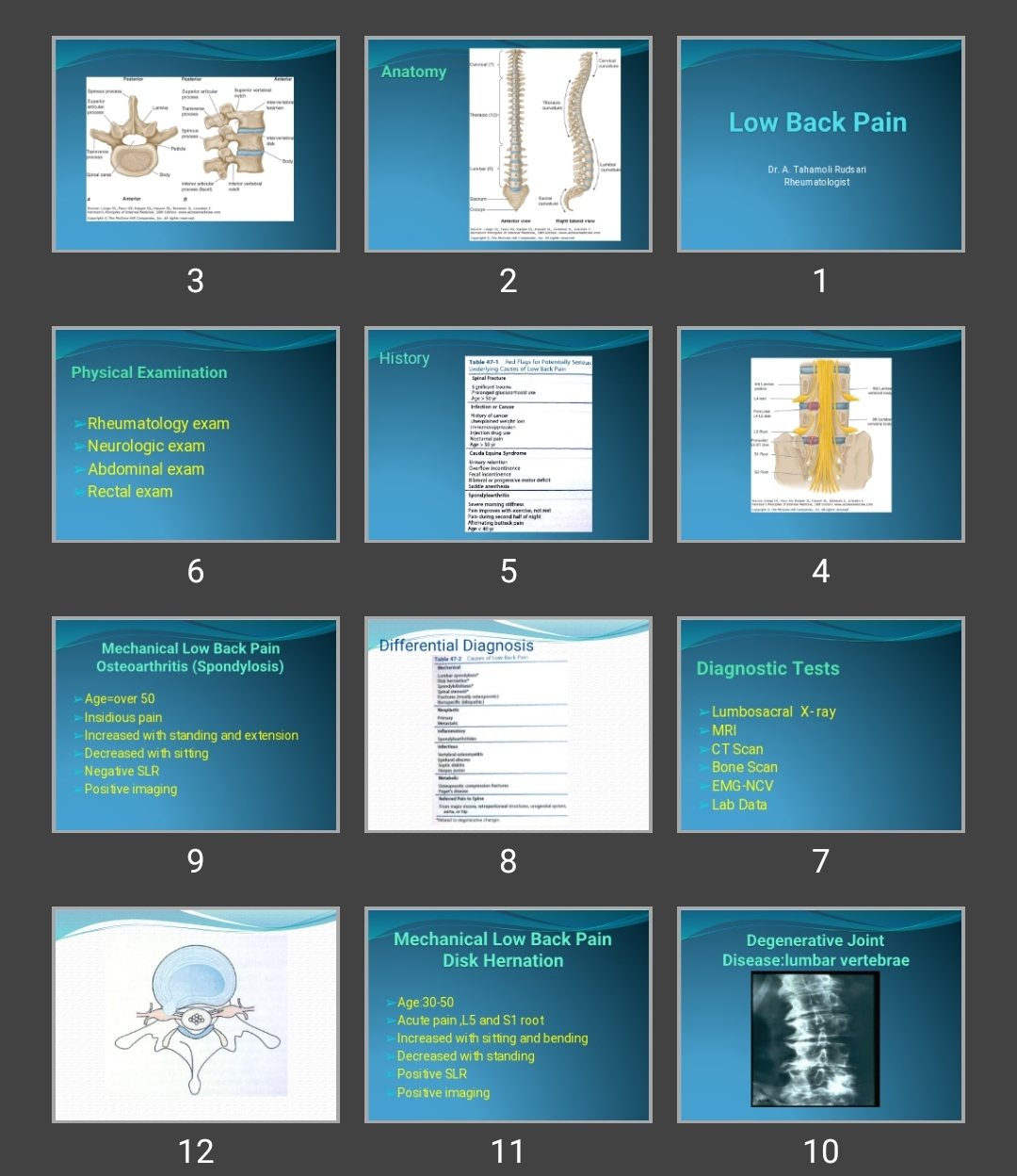 پاورپوینت Low Back Pain