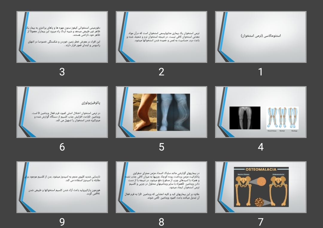 پاورپوینت استئومالاسی (نرمی استخوان)