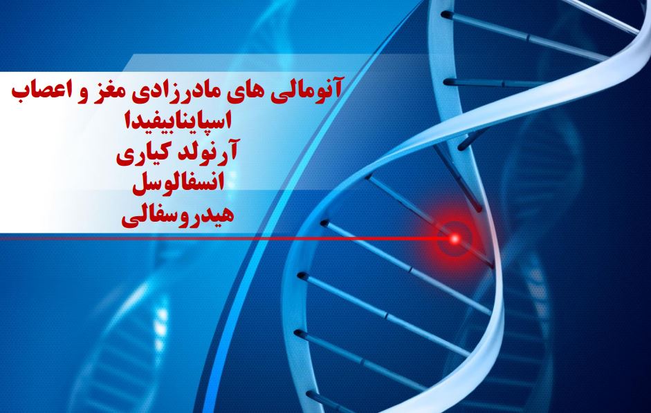 آنومالی های مادرزادی مغز و اعصاب