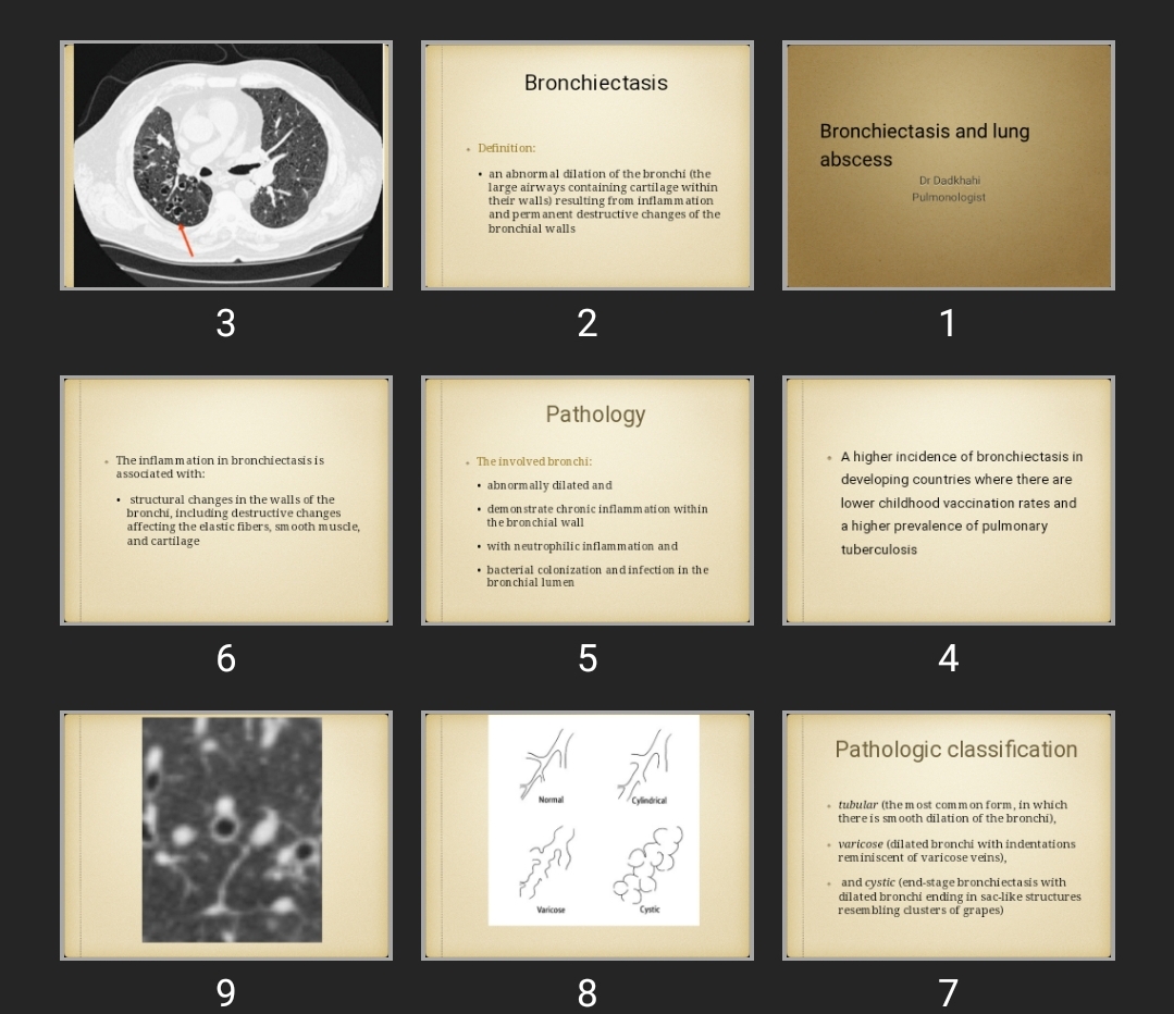 پاورپوینت Bronchiectasis and lung abscess