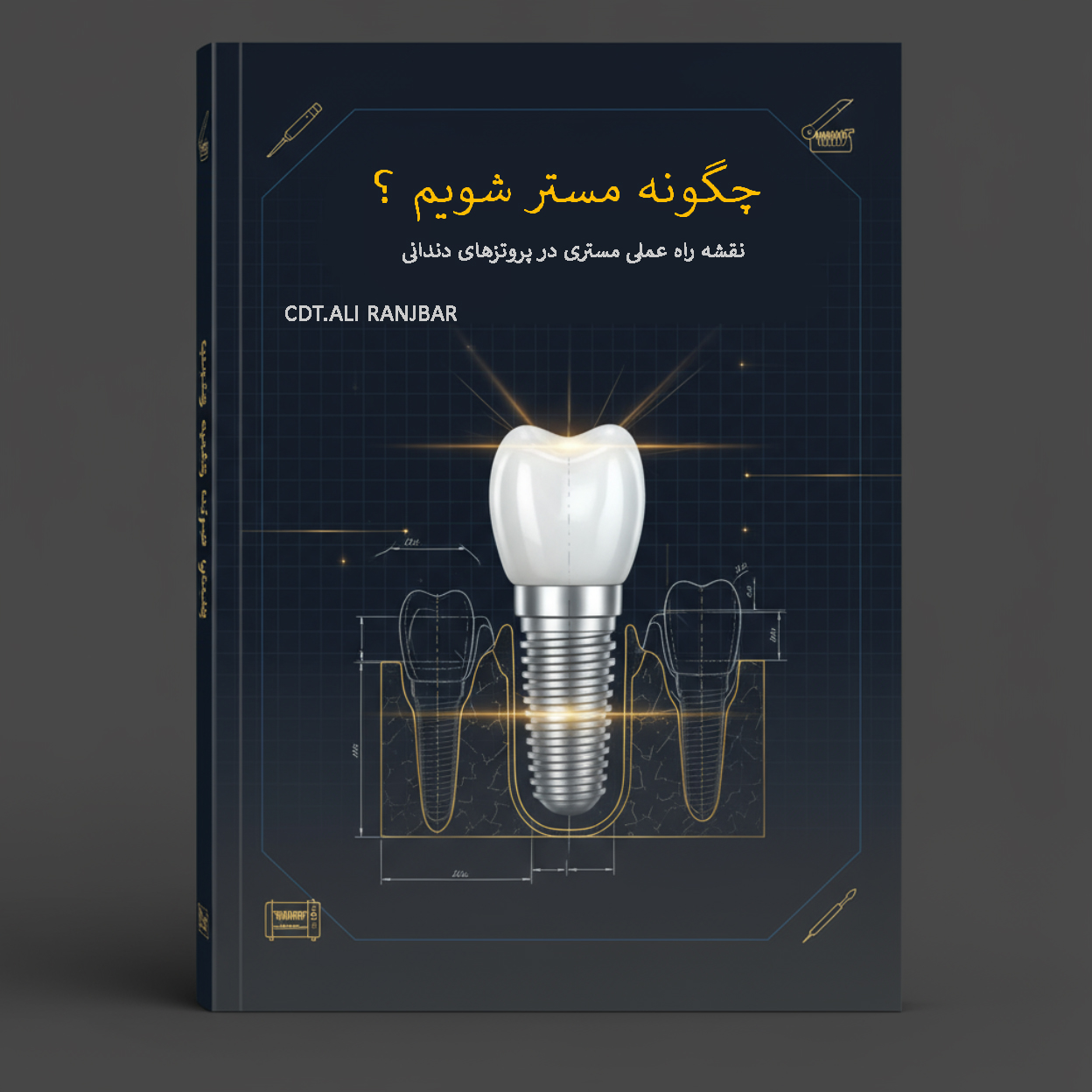 چگونه مستر شویم ؟ “نقشه راه عملی مستری در پروتزهای دندانی”