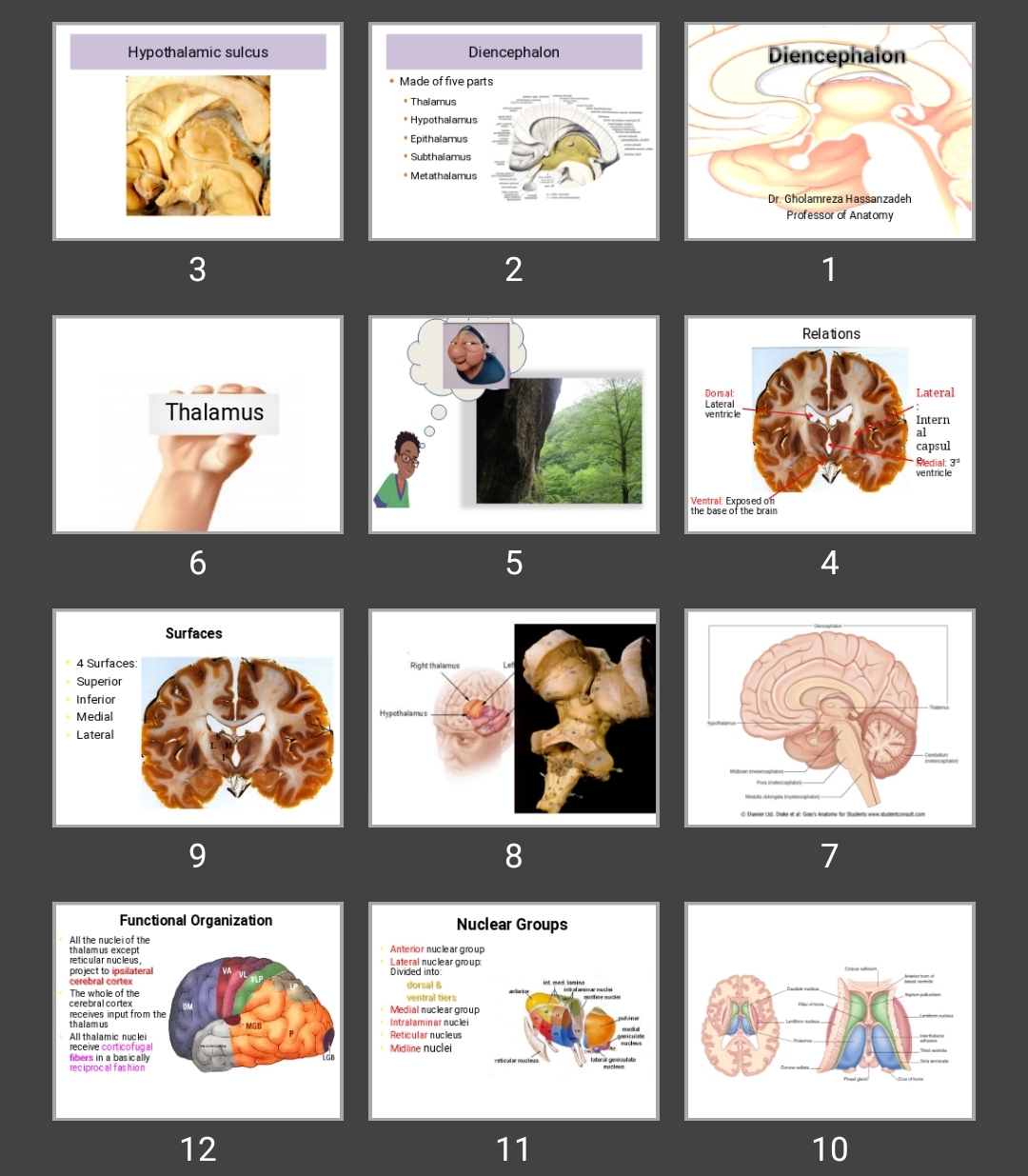 پاورپوینت Diencephalon