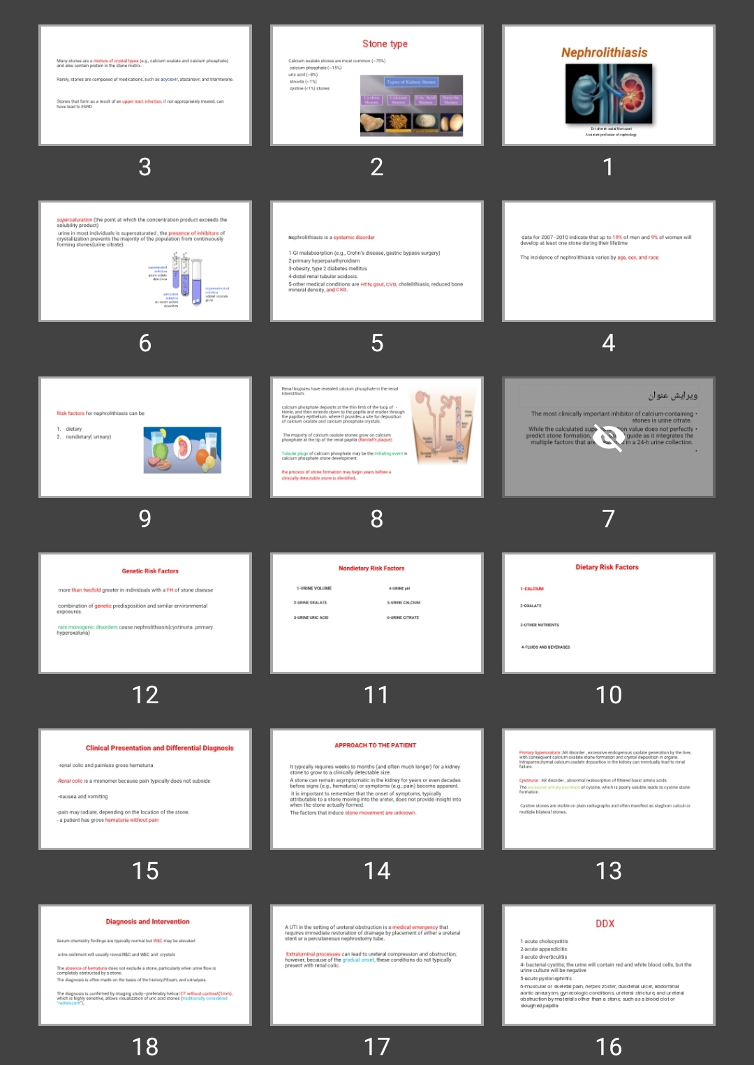 پاورپوینت Nephrolithiasis