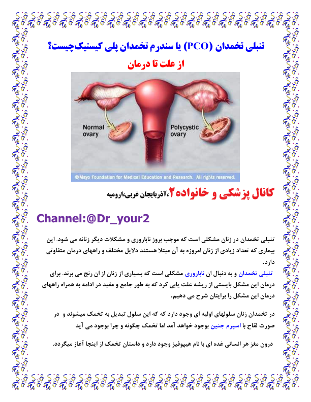 تخمدان پلی کيستيک 🔬 نسخه کامل ✅