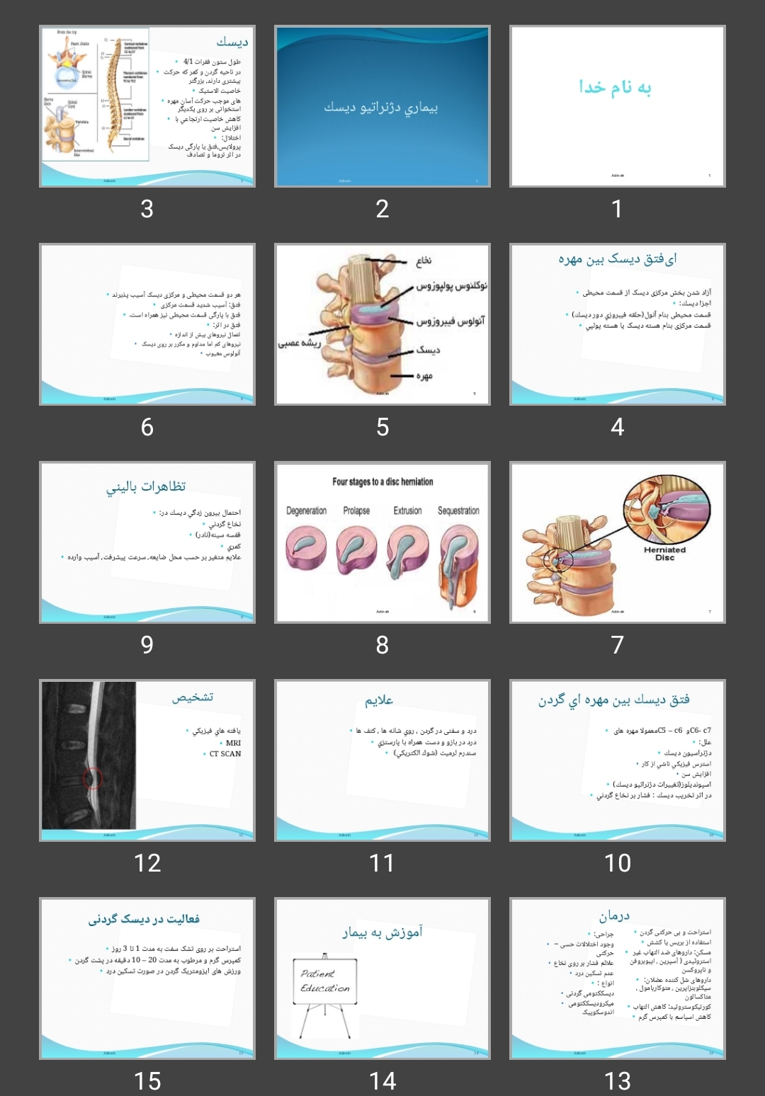 پاورپوینت بيماری دژنراتيو ديسک