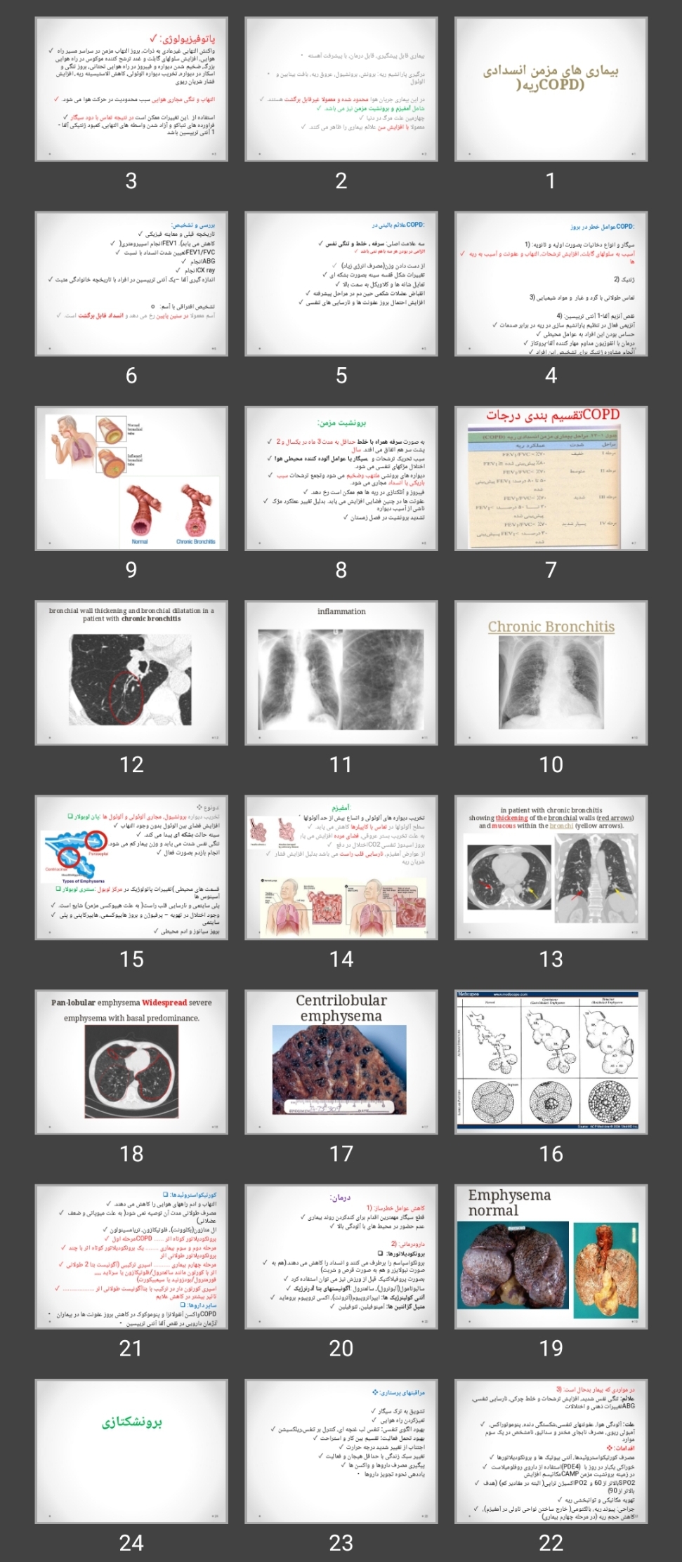 پاورپوینت بیماری های مزمن انسدادی ریه(COPD)