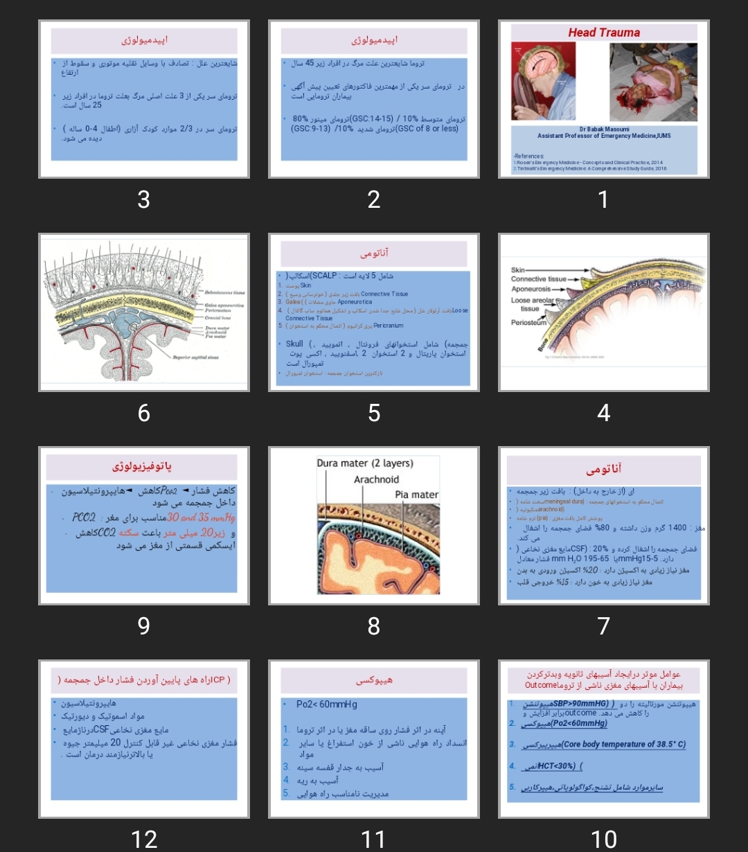 پاورپوینت ترومای سر
