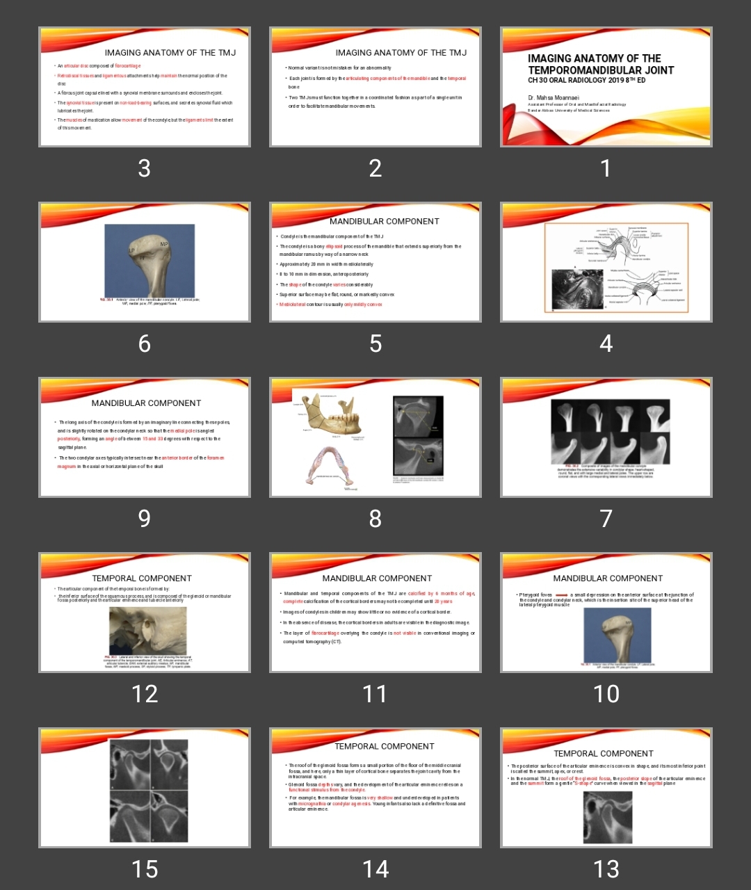 پاورپوینت Imaging Anatomy of the Temporomandibular Joint
