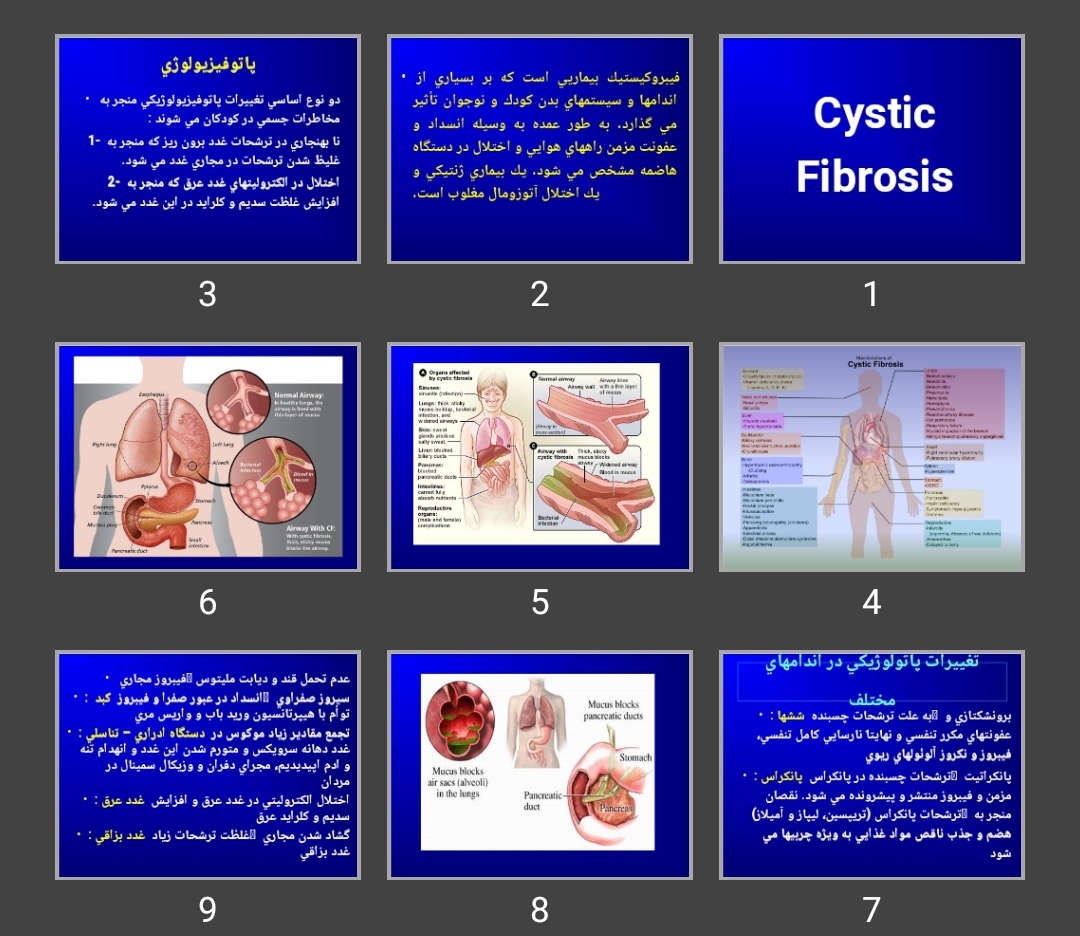 پاورپوینت فيبروكيستيک (Cystic Fibrosis)