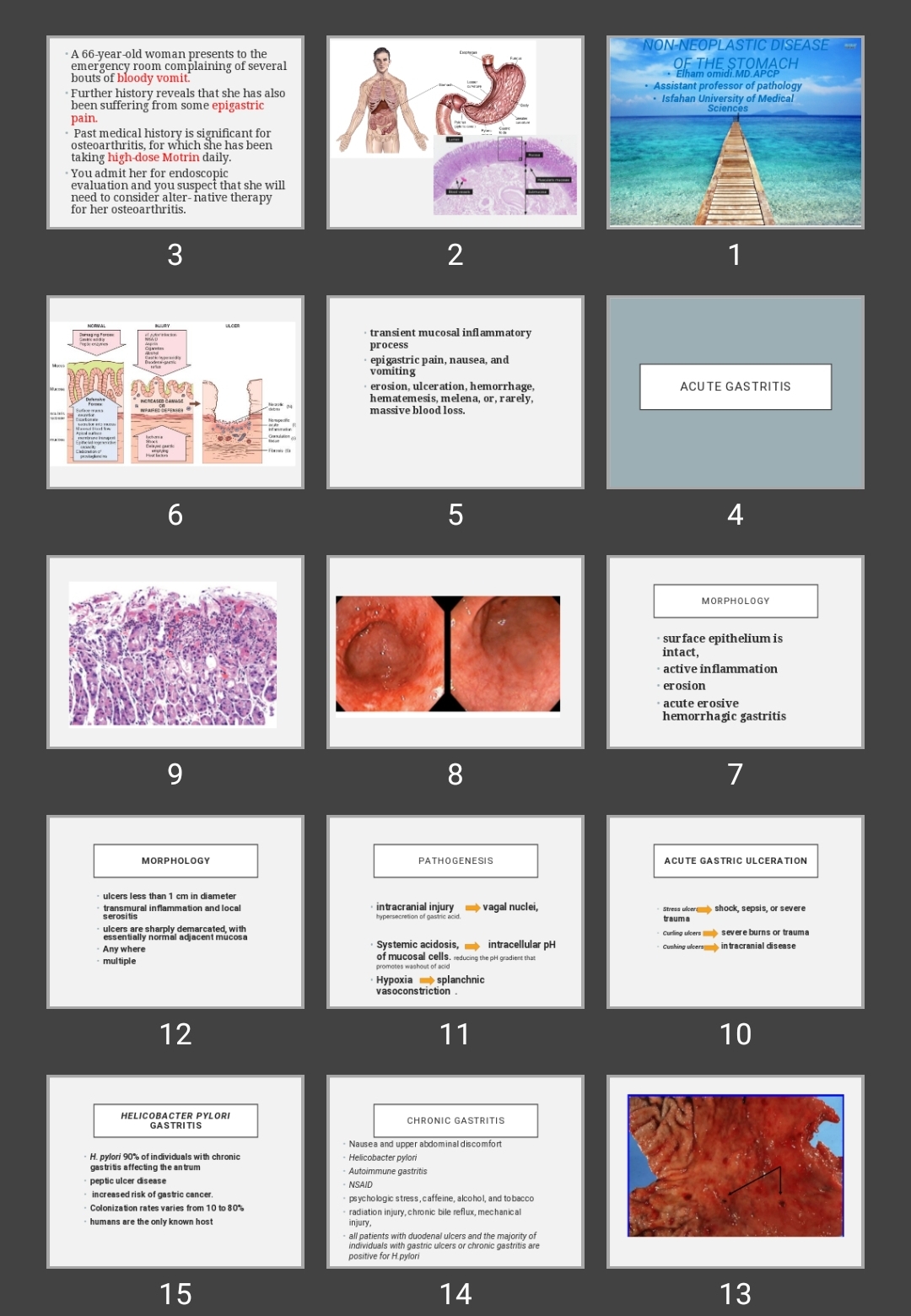 پاورپوینت NON-NEOPLASTIC DISEASE OF THE STOMACH