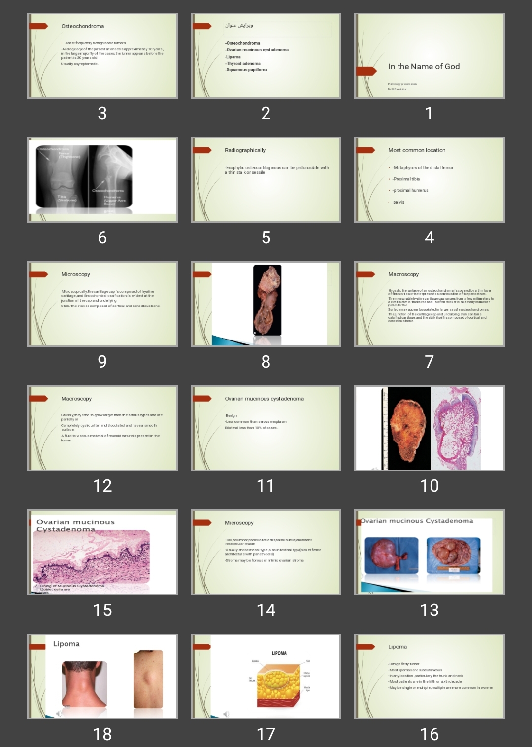 پاورپوینت Osteochondroma -Ovarian mucinous cystadenoma -Lipoma -Thyroid adenoma -Squamous papilloma