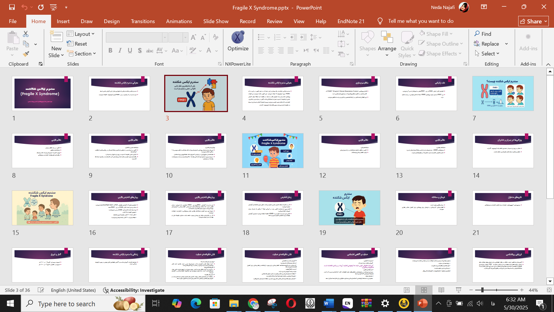 پاورپوینت سندرم ایکس شکننده