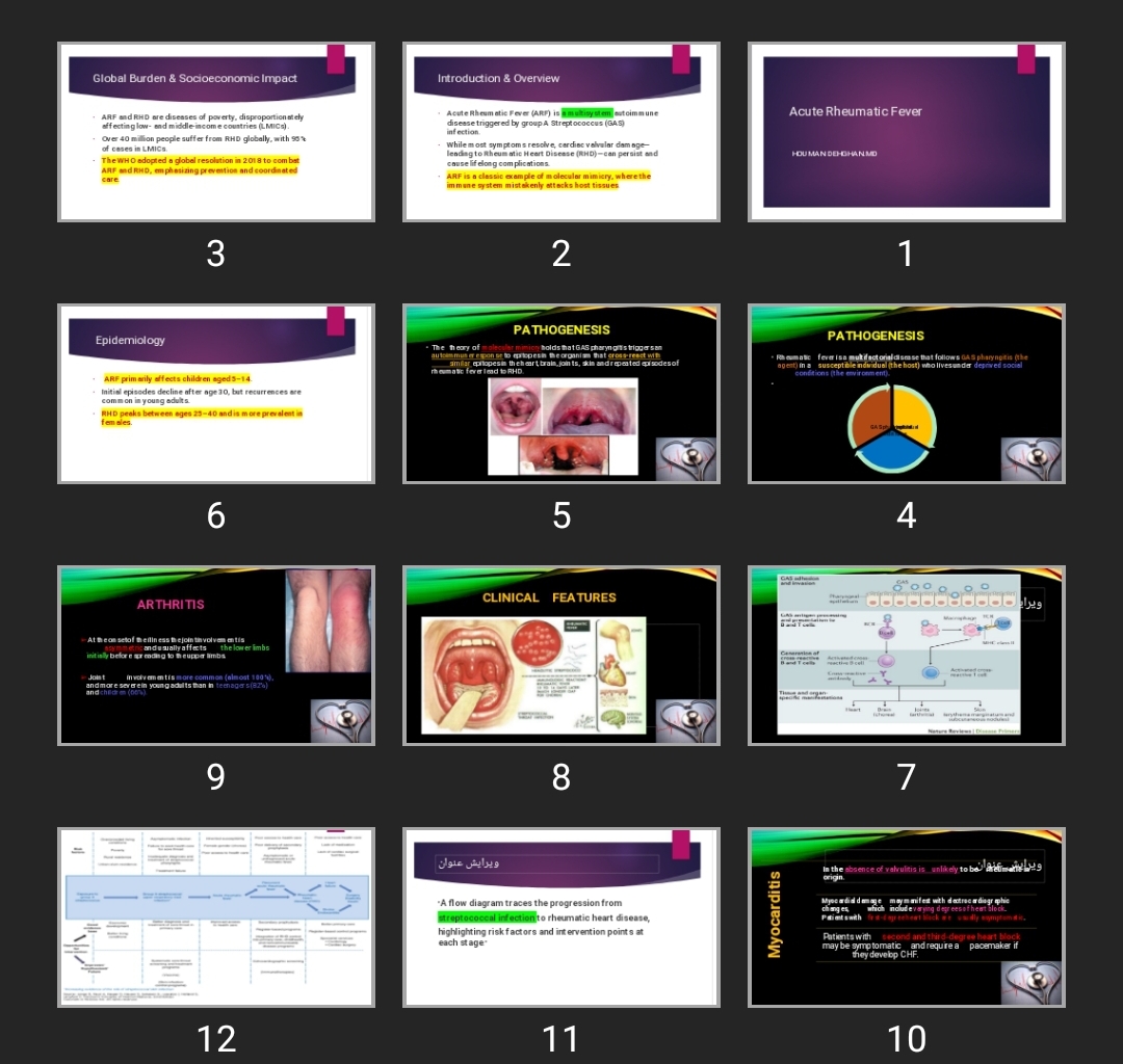 پاورپوینت Acute Rheumatic Fever