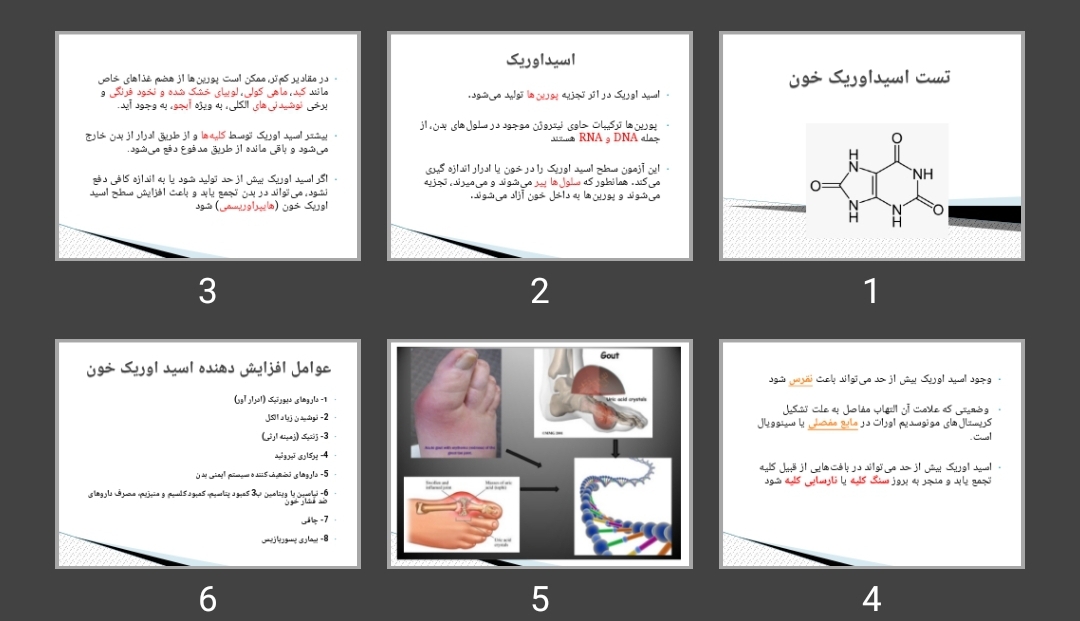 پاورپوینت تست اسید اوریک خون