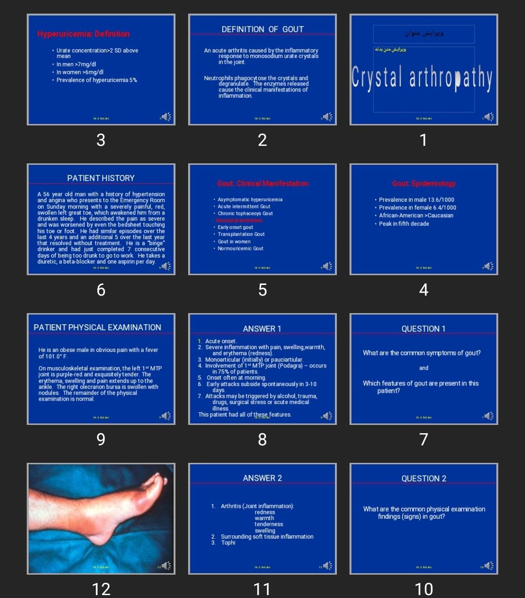 پاورپوینت Gout Crystal arthropathy
