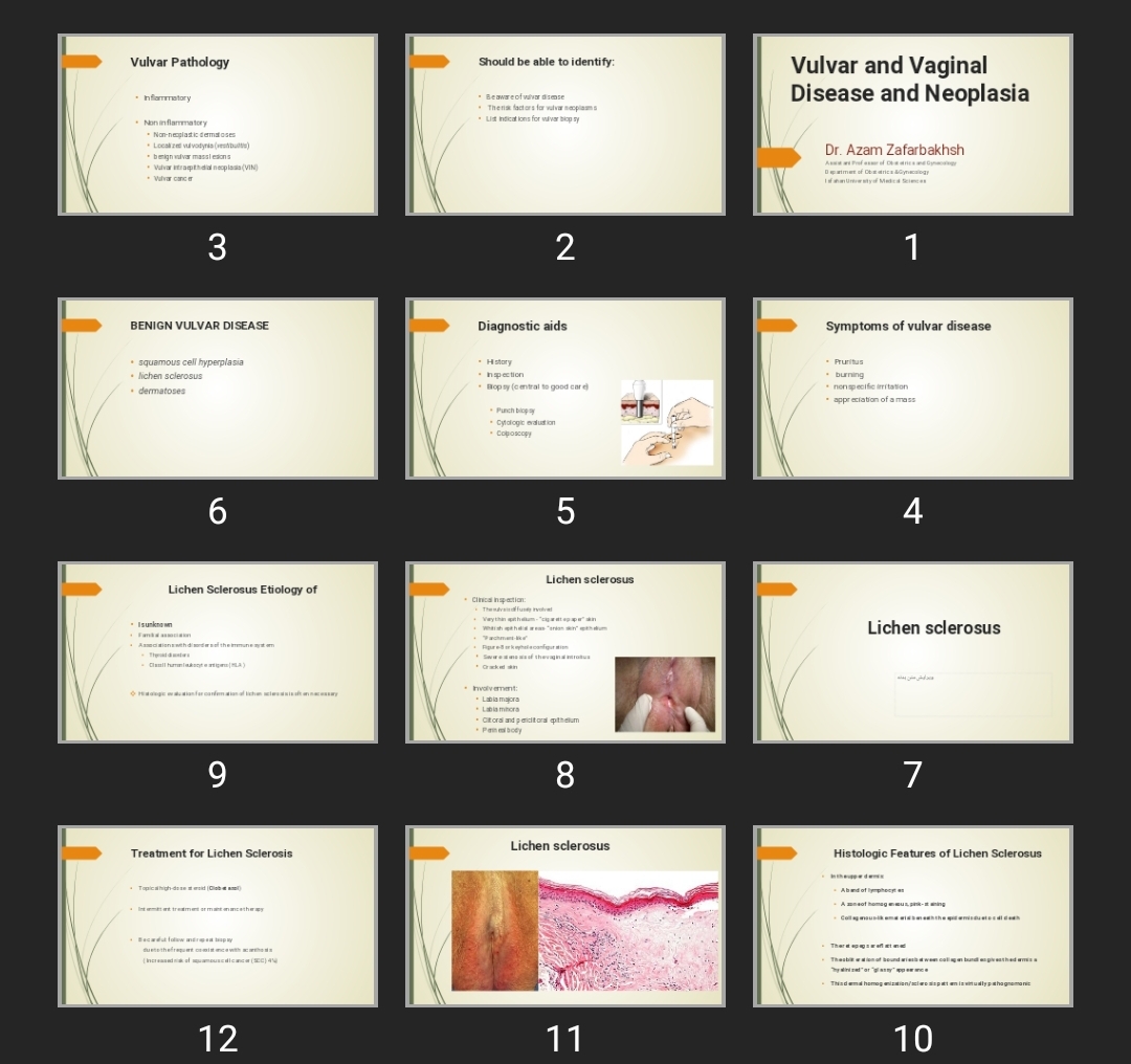 پاورپوینت بیماری و نئوپلازی ولو و واژن Vulvar and Vaginal Disease and Neoplasia