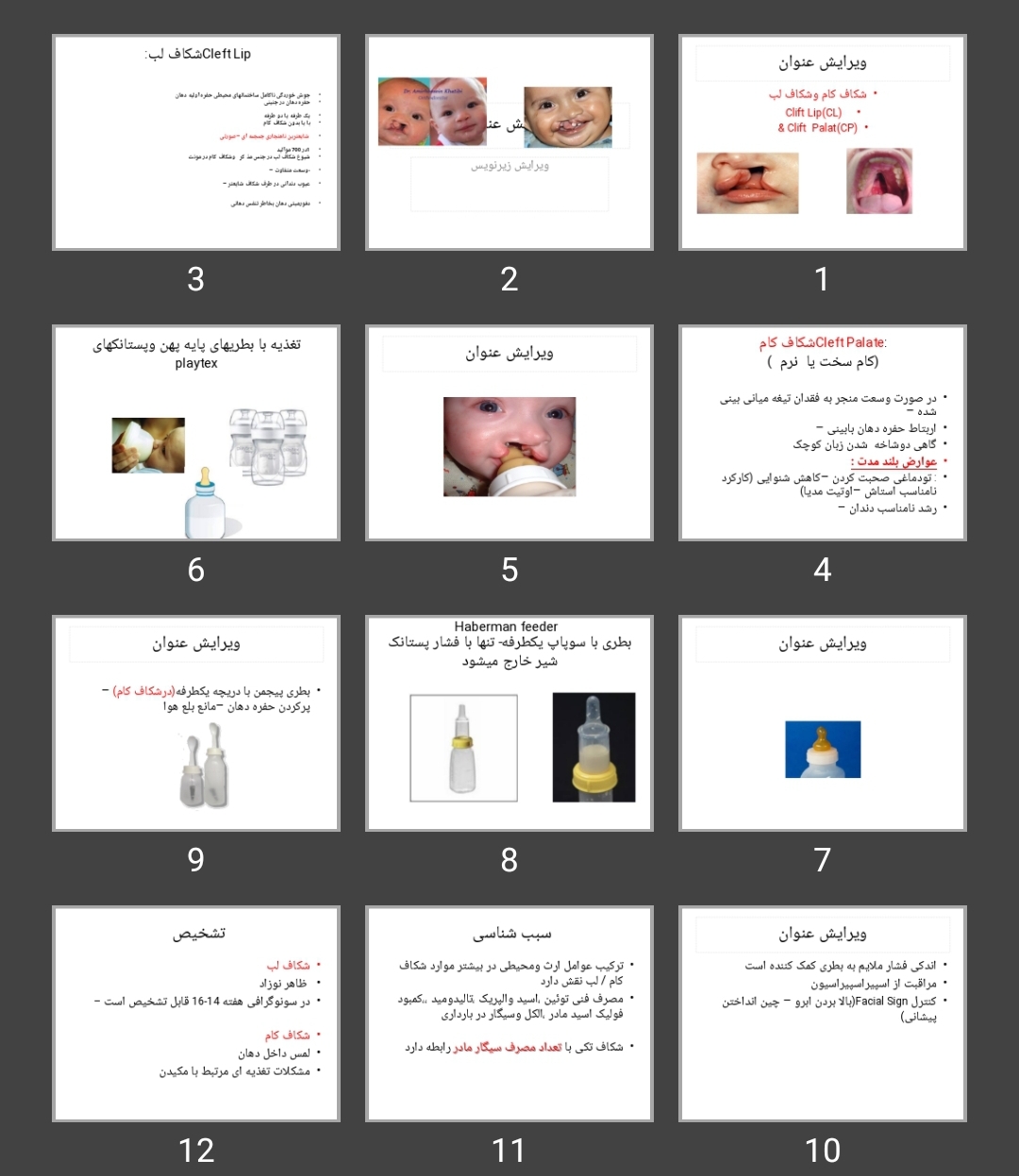 پاورپوینت شکاف کام و شکاف لب