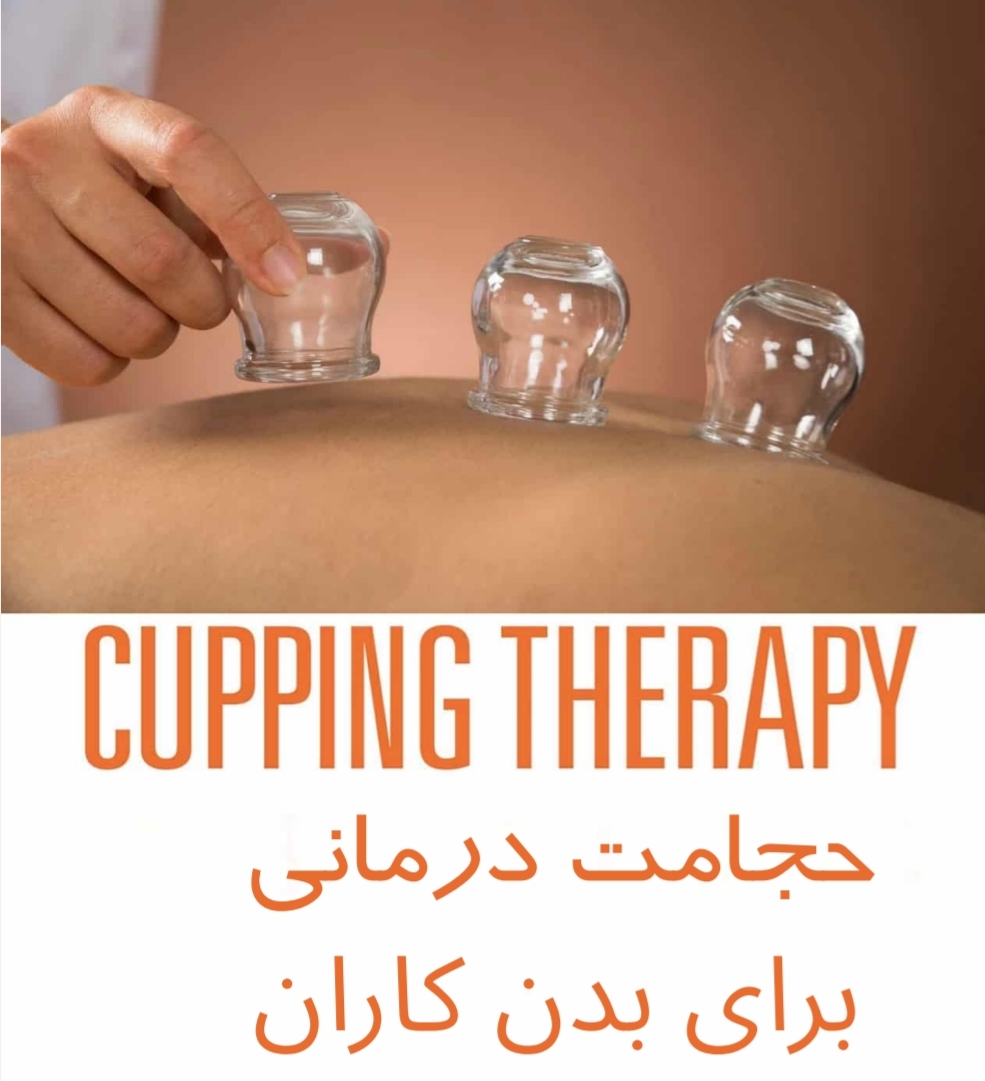 حجامت درمانی برای بدن کاران