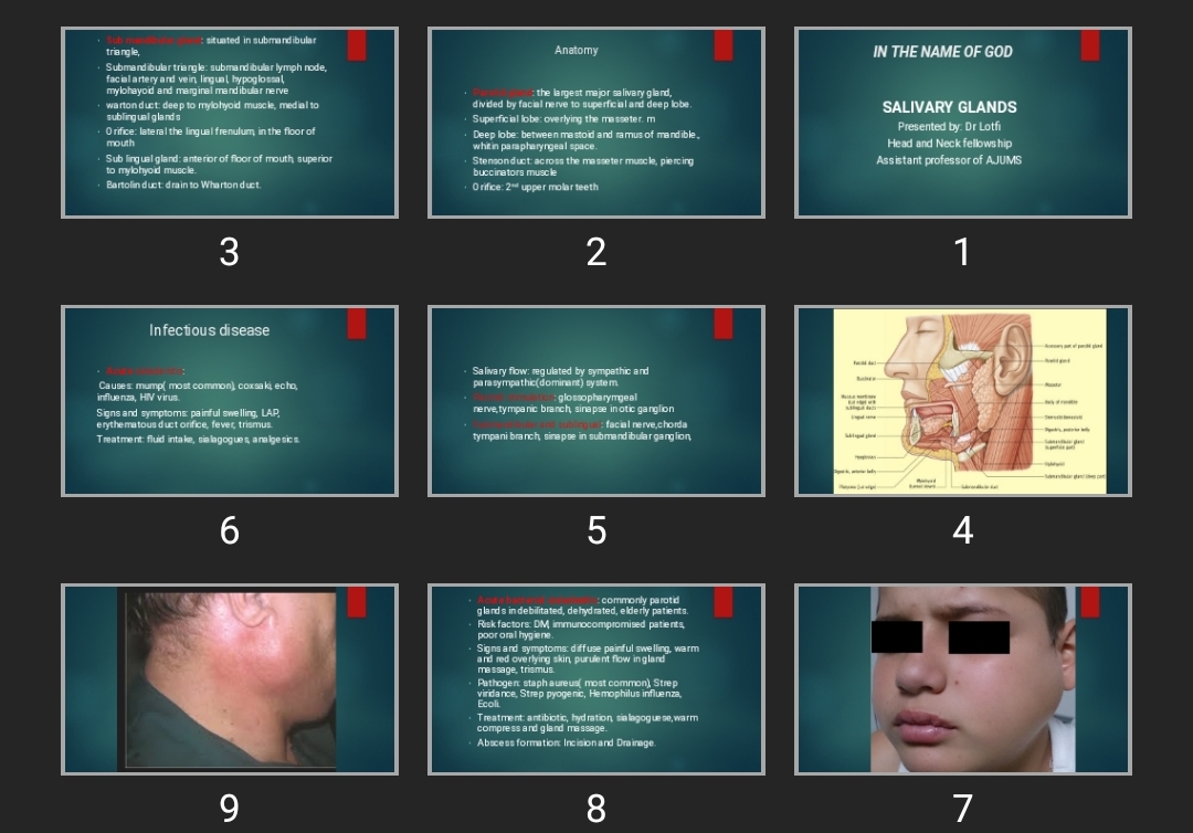 پاورپوینت SALIVARY GLANDS