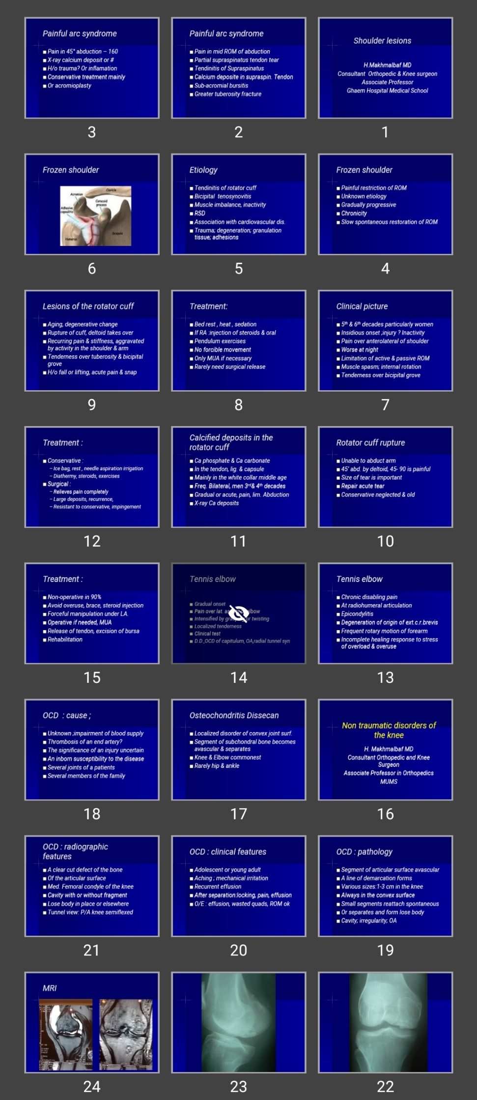 پاورپوینت Shoulder lesions