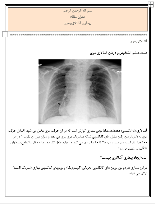 مقاله بیماری آشالازی مری