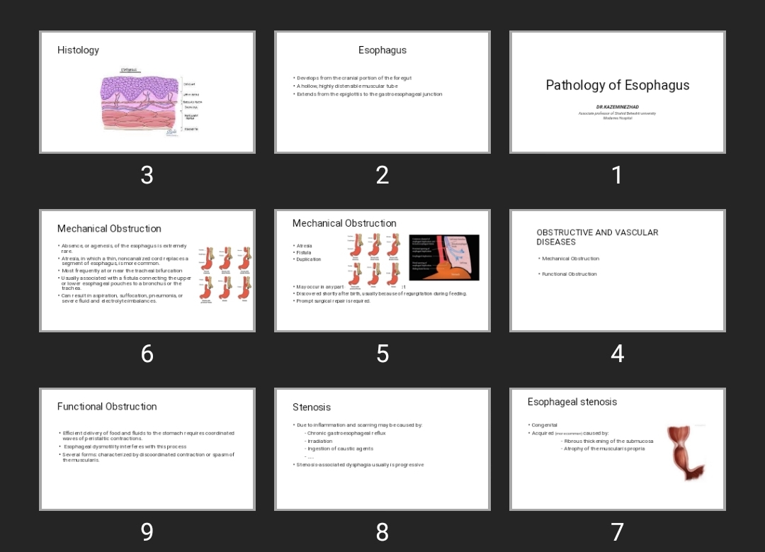 پاورپوینت Pathology of Esophagus