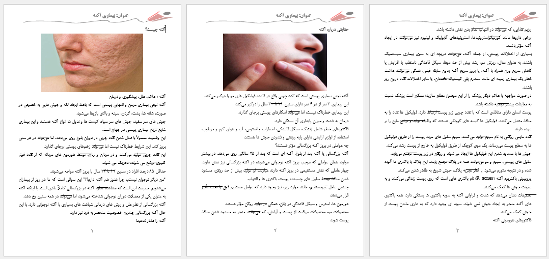 مقاله بیماری آکنه