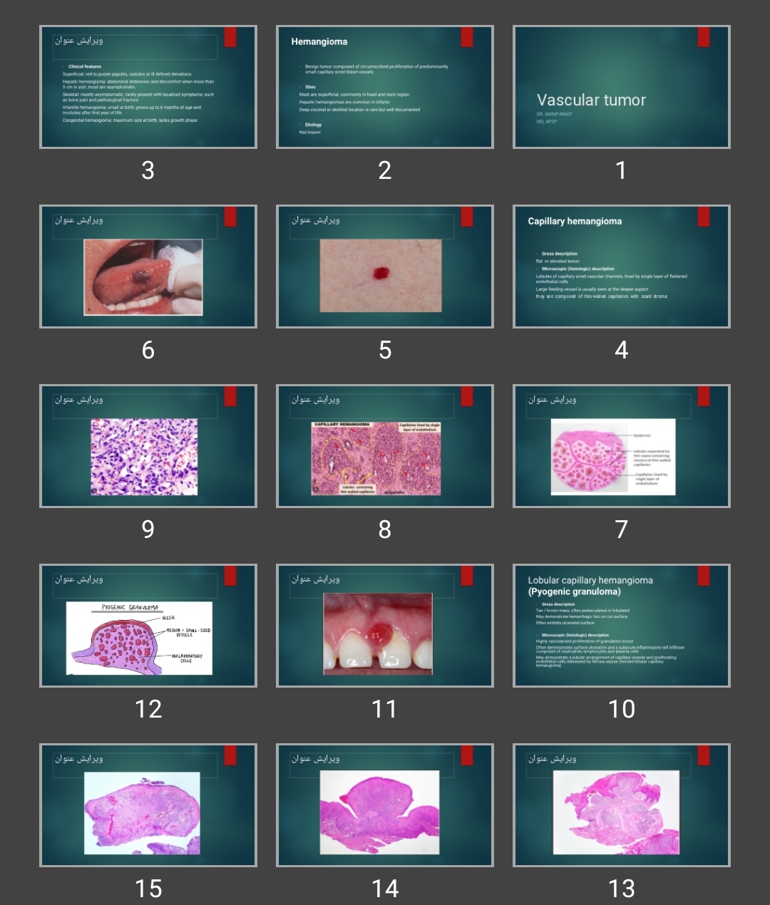 پاورپوینت Vascular tumor