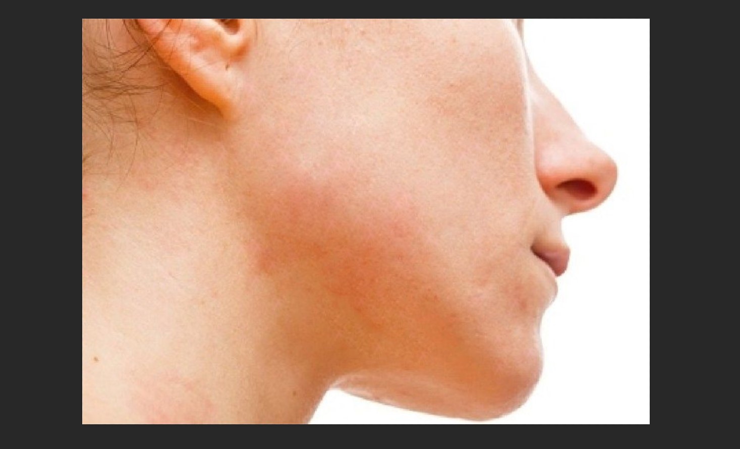 معرفی ابزار روتوش | Healing Brush