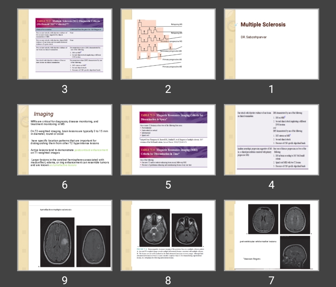 پاورپوینت  Multiple Sclerosis MS