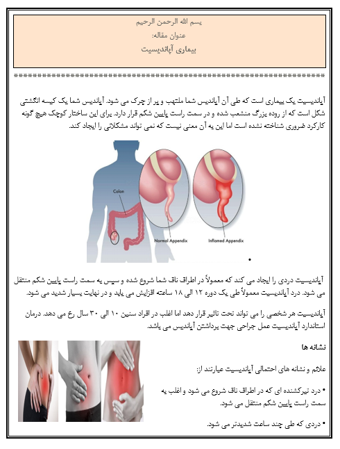 مقاله بیماری آپاندیسیت