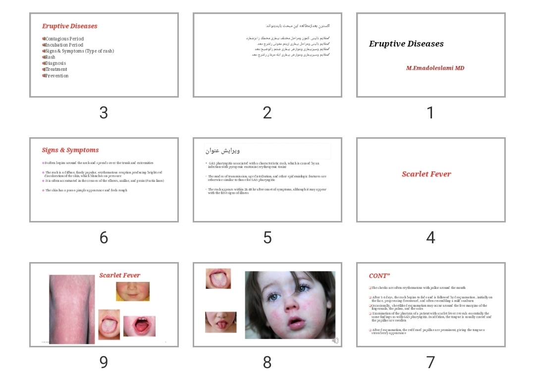 پاورپوینت Eruptive Diseases