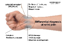 تشخیص افتراقی های مچ درد (ویژه دانشجویان پزشکی)