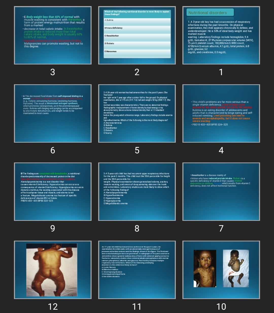 پاورپوینت Nutritional disorders