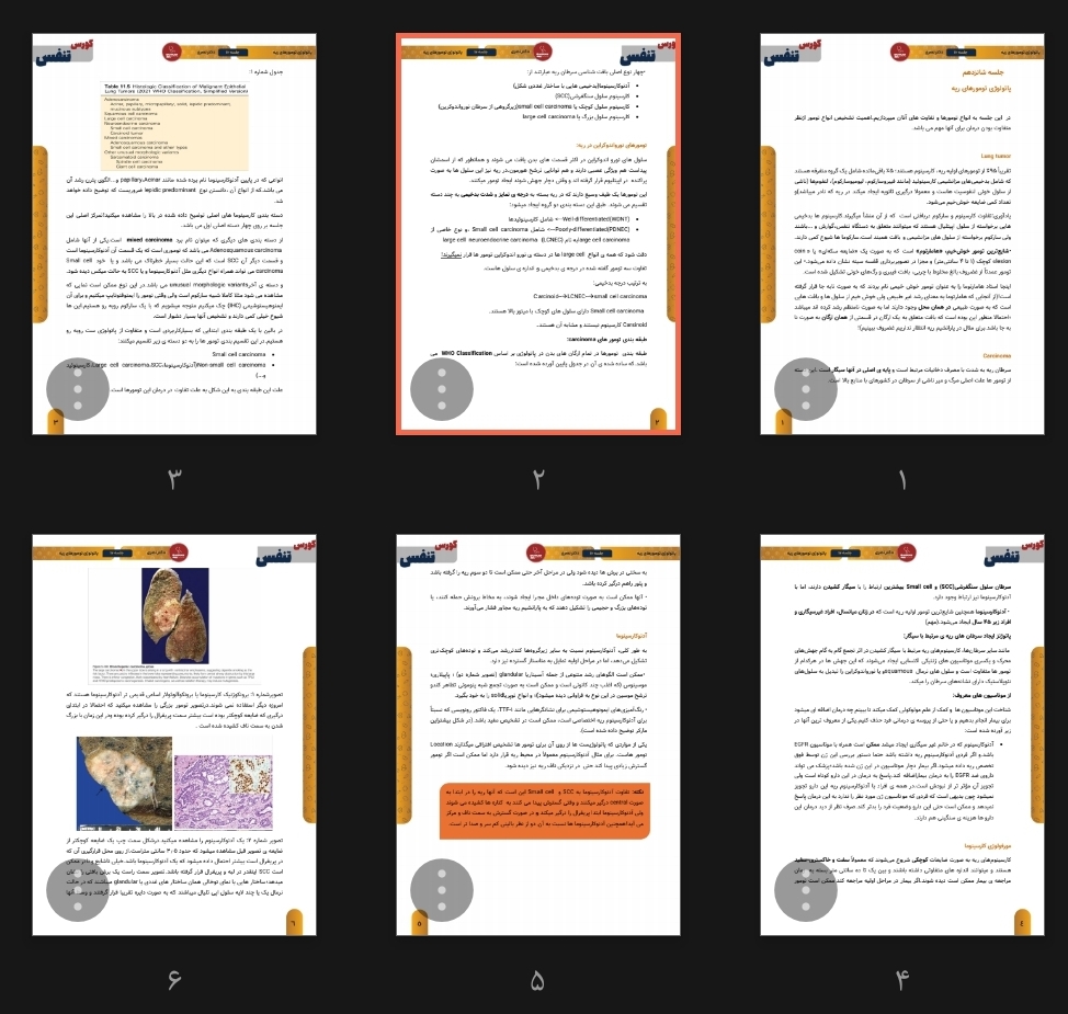 جزوه پاتولوژی ریه (تومور‌های ریه)