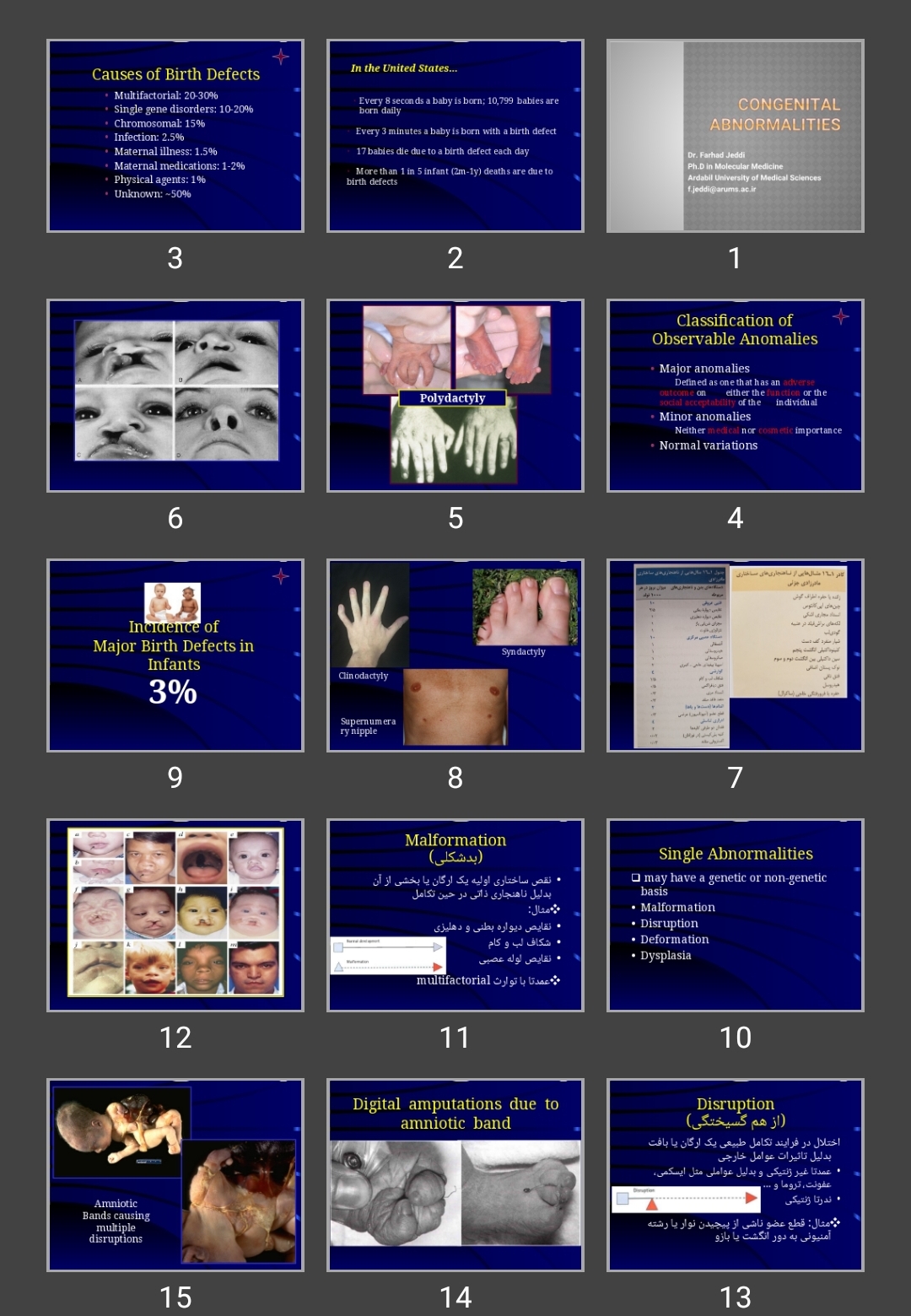 پاورپوینت Congenital abnormalities