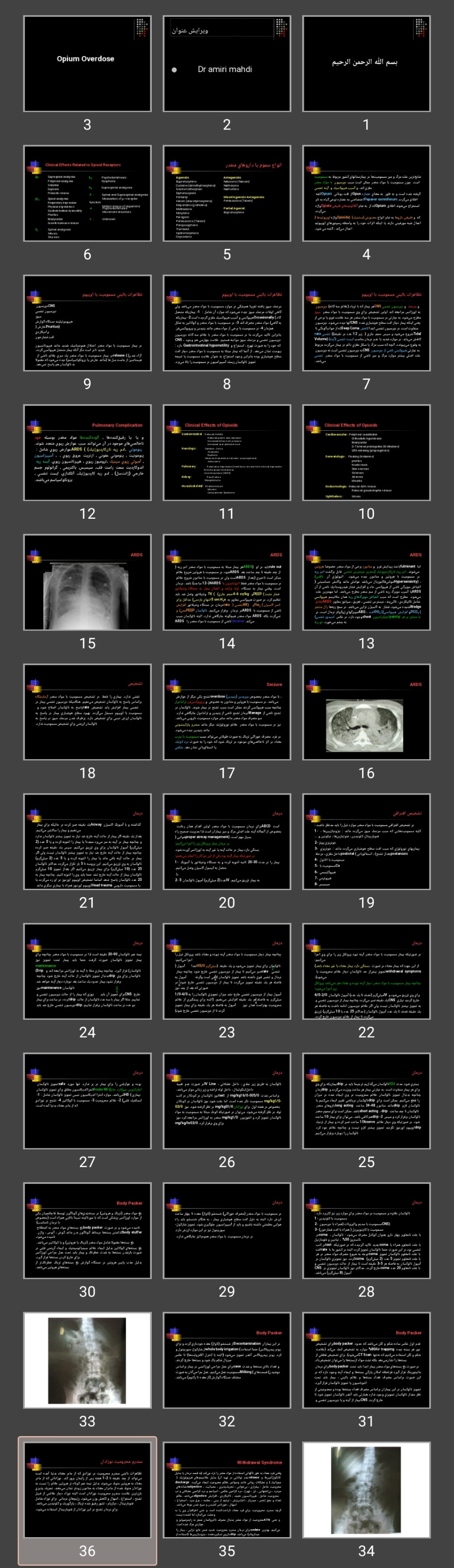 پاورپوینت مسمومیت