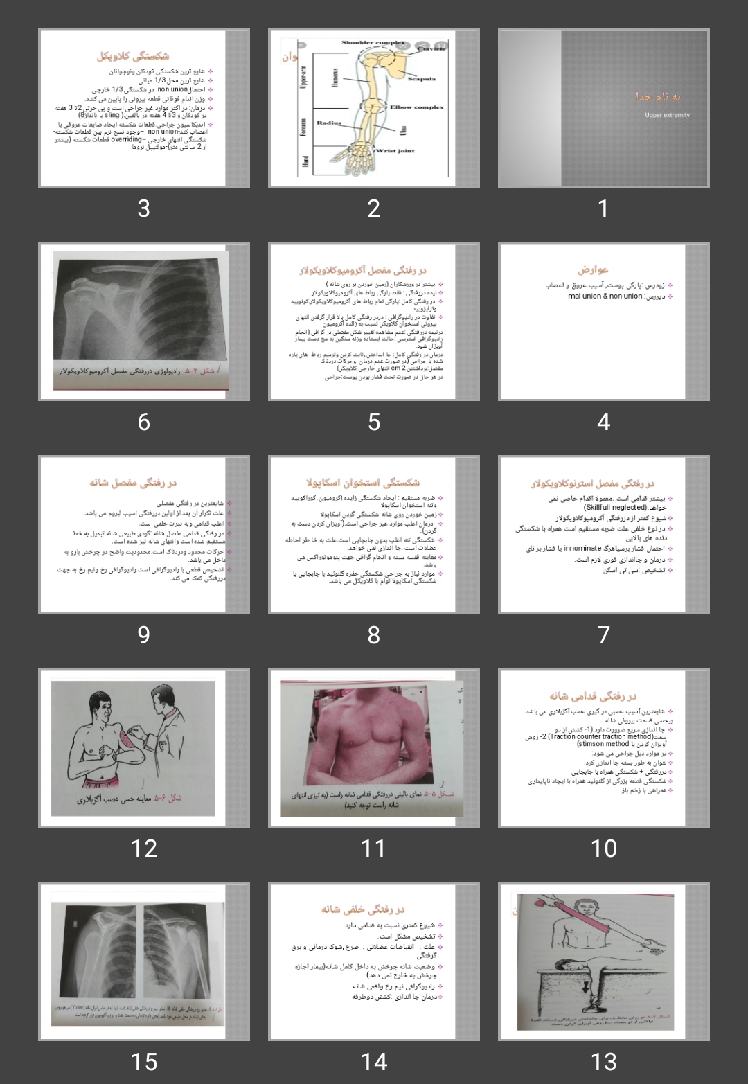 پاورپوینت Upper extremity