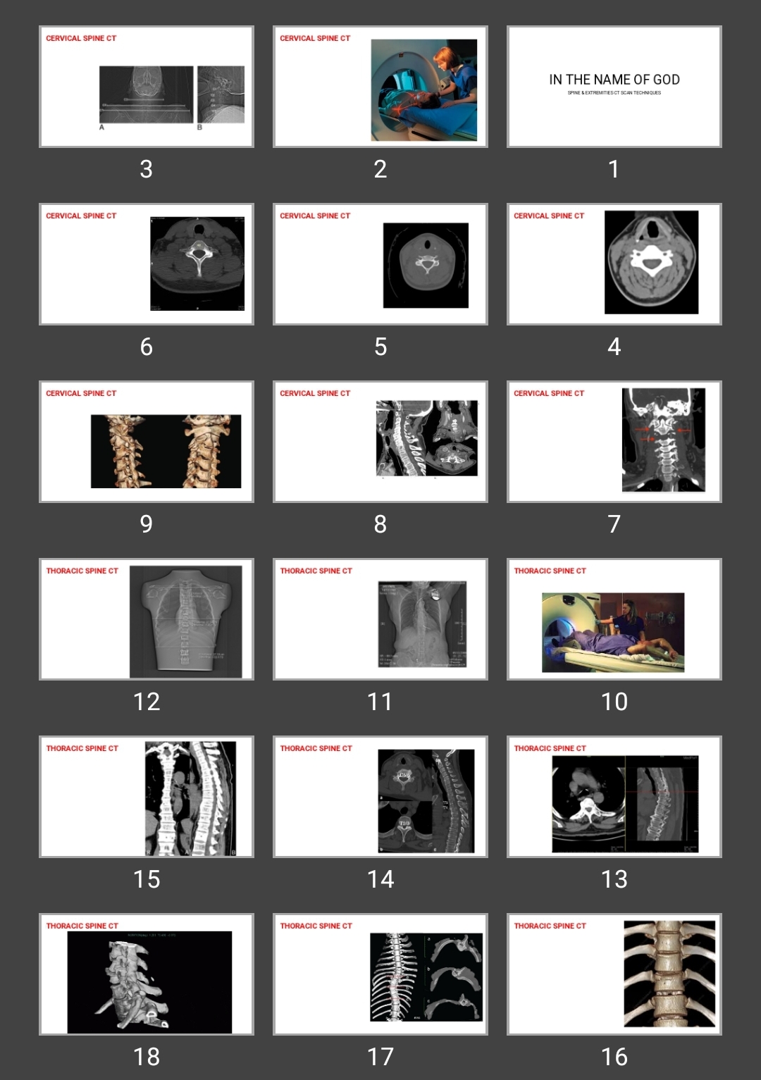 پاورپوینت SPINE & EXTREMITIES CT SCAN TECHNIQUES